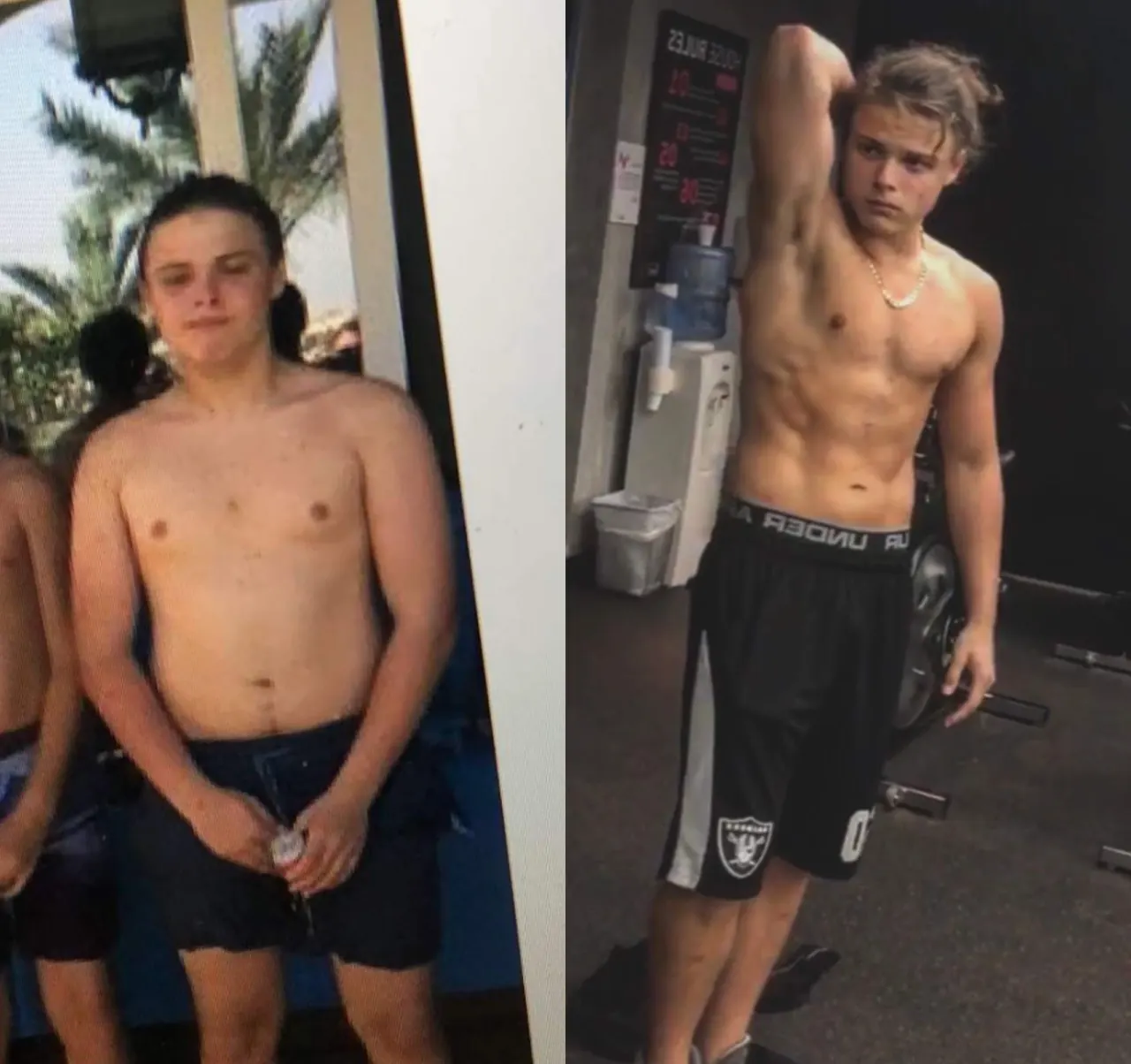 Louie, before and after